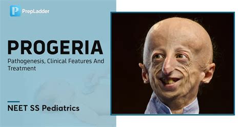 progeria porn|Progeria Videos .